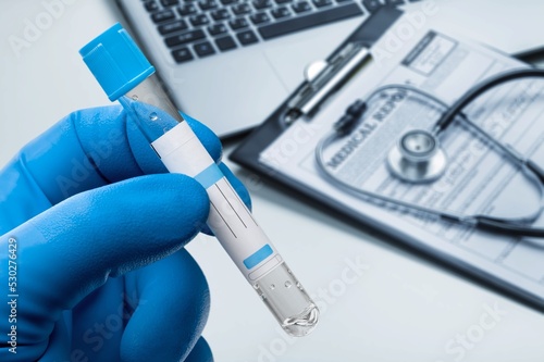 medical office work table with a sample from a patient positive for monkey pox virus (MPXV).