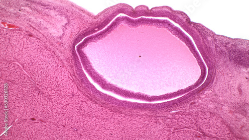 Light micrograph of human ovary showing Graafian follicle containing secondary oocyte. This maybe an off-center cross section of a mature follicle because of its large size. photo