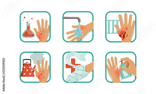 Burns Degree and First Aid or Treatment with Wounded Hand Vector Set