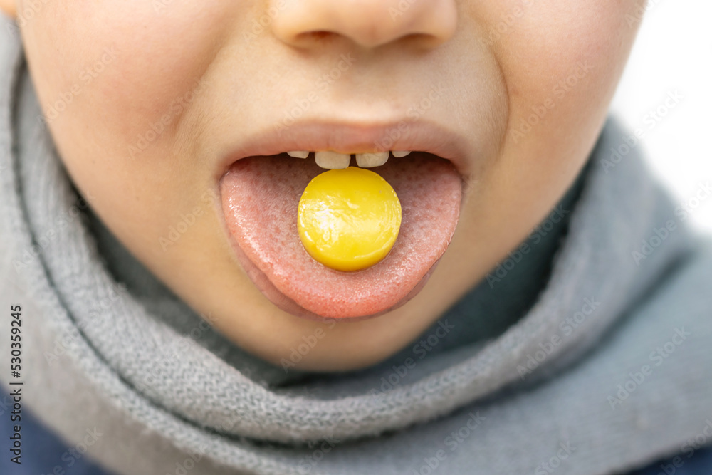 kid hold on tongue anaesthetic sore throat lozenges for pain redness