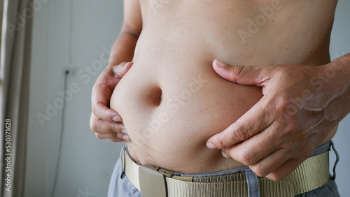 A middle-aged man, taking off his shirt, saw his belly with excess fat.
