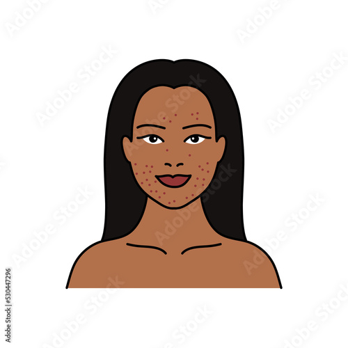 acne doodle icon, vector color line illustration