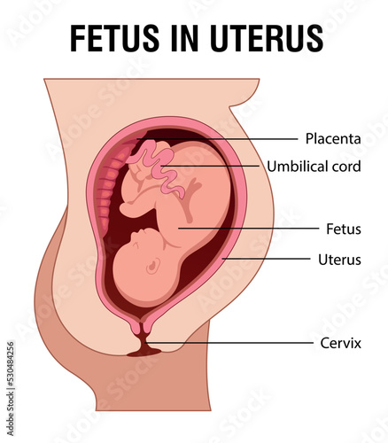 Fetus in Uterus During Pregnancy. Placental Locations.  Pathology. 
Detailed Medical vector illustration.
