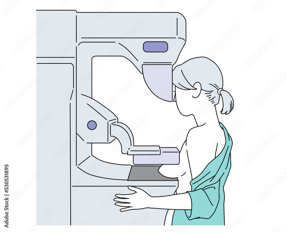 マンモグラフィー検査を受ける必要がありますか?仕組みを理解する