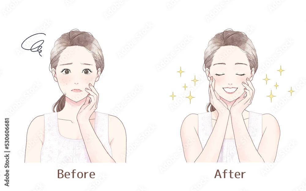 Illustration of a woman suffering from rough skin, before after. Illustration of a woman suffering from rough skin, before after.