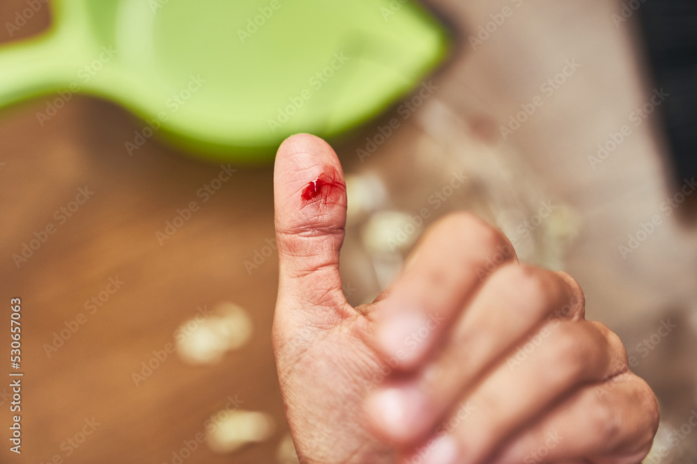 Selective focus on a cut female finger on the background of a split cup and a brush with a dustpan for cleaning. A wound with blood received when cleaning broken dishes. High quality photo