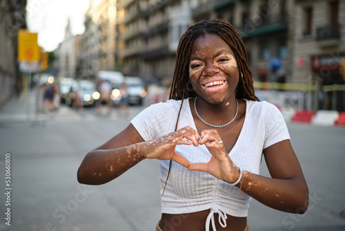 Young woman with vitiligo smiling while making heart shape with hands outdoors on the street. photo