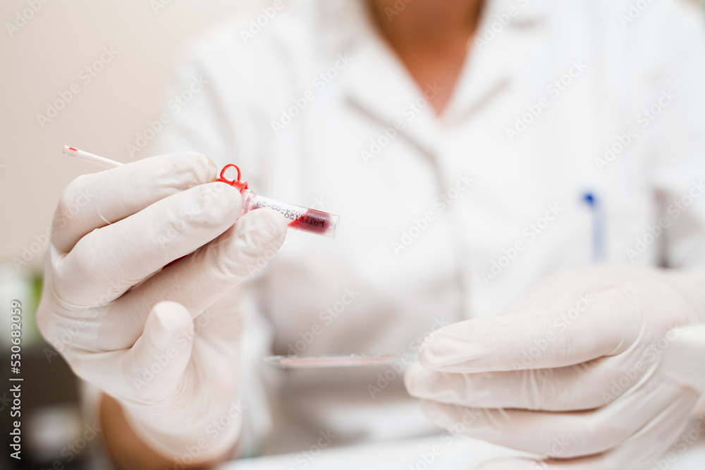 Laboratory assistant holds test tube close-up for gynecological and cytological analysis. Woman scientist working in medical lab. Laboratory assistant holds test tube close-up for gynecological and cytological analysis. Woman scientist working in medical lab.