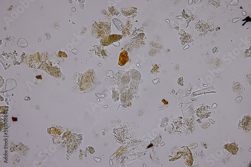 Eggs of helminth and Finding parasites in feces, analyze by microscope in laboratory. photo