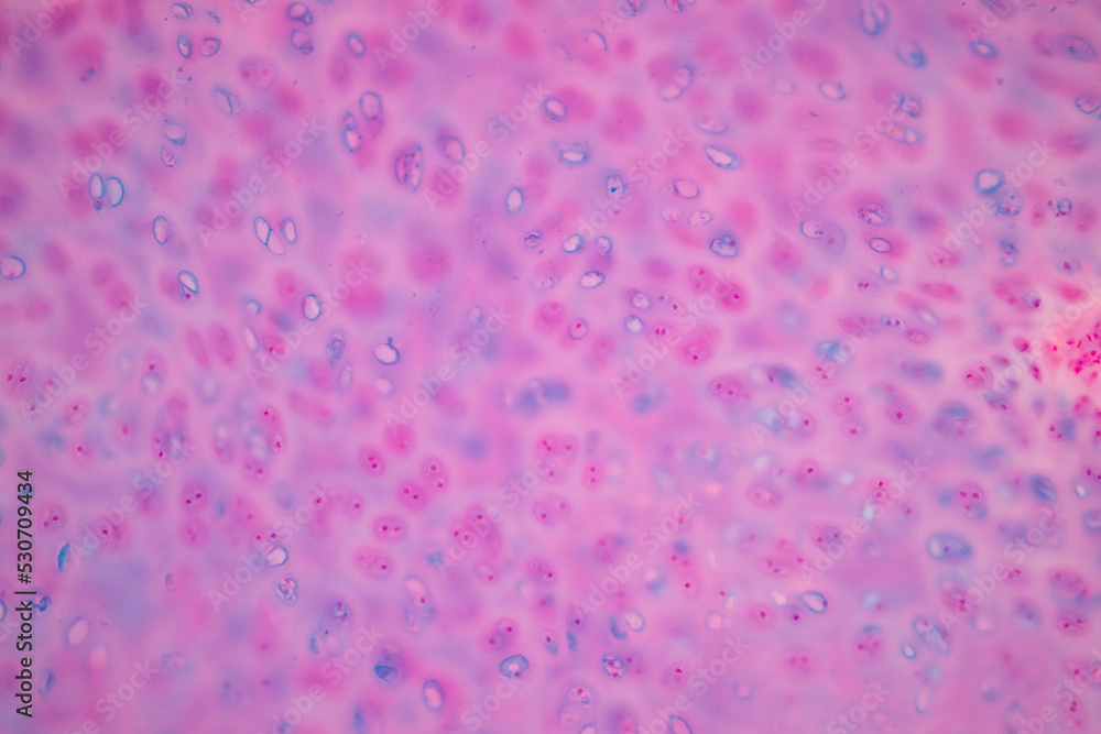 Connective tissue human and Striated muscle human under the microscope in Lab. Connective tissue human and Striated muscle human under the microscope in Lab.