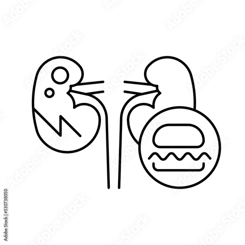 kidney problem, Causes, line editable icons for web design