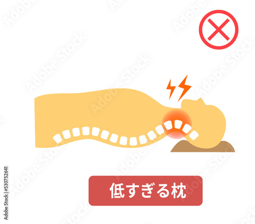 枕の高さとストレートネックのイラスト