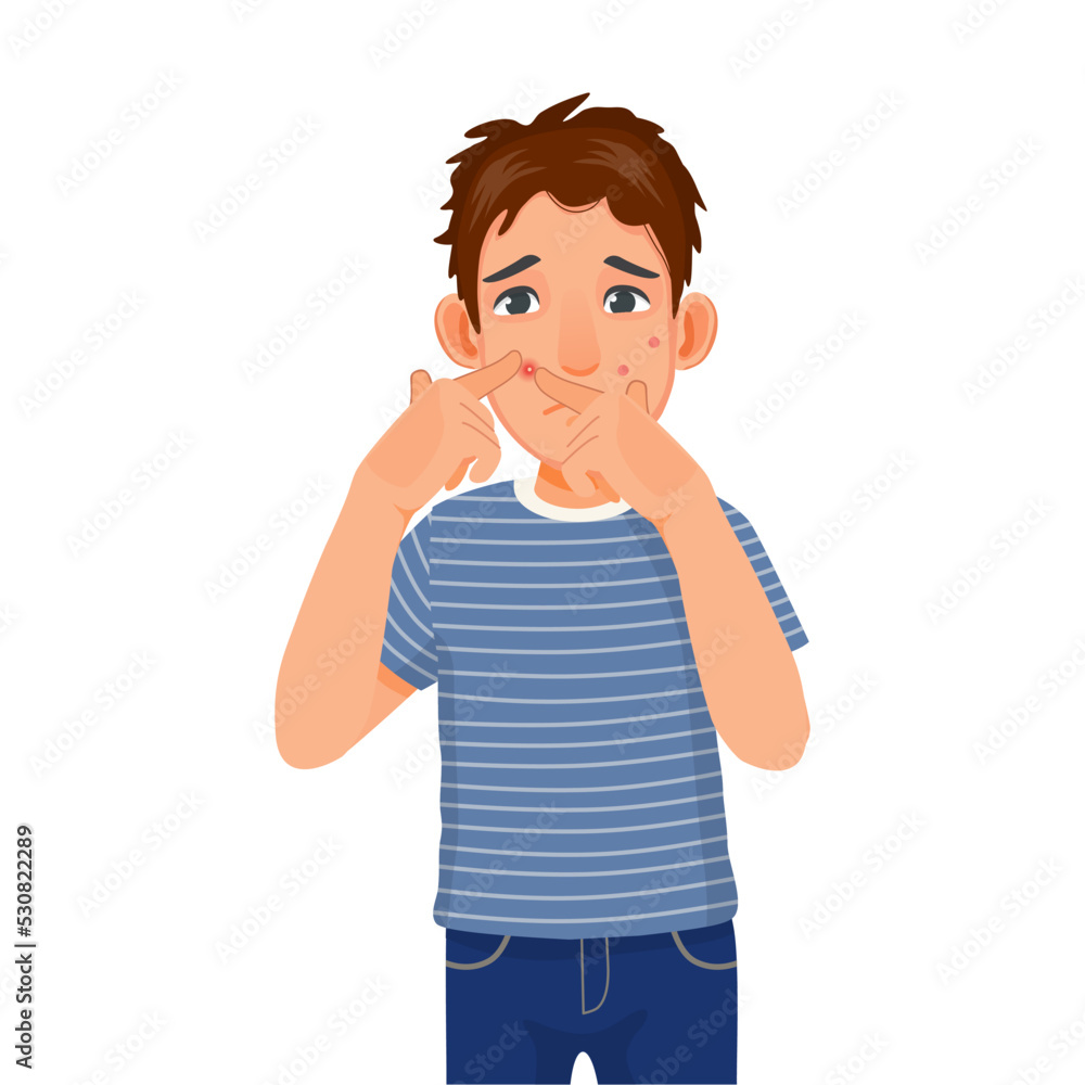 Young man with acne skin problem squeezing pimples on his face Young man with acne skin problem squeezing pimples on his face