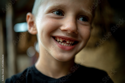 Fotografia portrait of a 6-year-old boy in close-up, whose baby tooth fell out