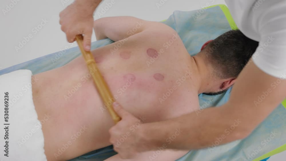Taking video form the top at spa salon the therapist man using the wooden stick to massage well the back muscles and get good results for his client Taking video form the top at spa salon the therapist man using the wooden stick to massage well the back muscles and get good results for his client