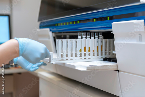 A scientist in a laboratory places test tubes with blood or urine in the container of a thermal analyzer. Modern Female scientist using urine analyzer to test samples. medical computerized equipment. 