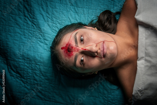 Scary image of a woman in halloween makeup with a wound on her forehead on a stretcher