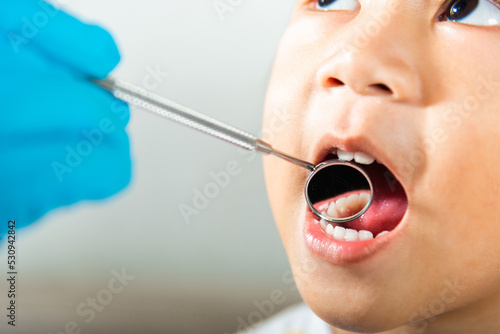 Dental kid health examination. Asian dentist making examination procedure for cute little girl open mouth  Doctor examines oral cavity of little child uses mouth mirror to checking teeth cavity