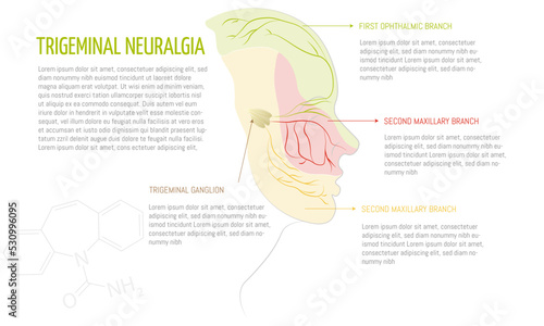 Infographic of the trigeminal neuralgia disease, areas affected by each branch of the trigeminal nerve. White background and space for text.