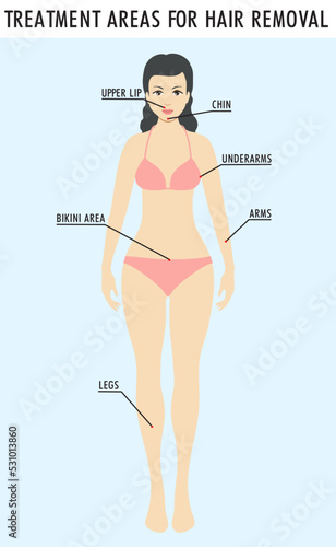 Removal female zones. Vector illustration epilation, symbol of depilation area. rea hair removal, girl in full growth with marked zones epilation. For beauty, SPA site, blogs of cosmetologist