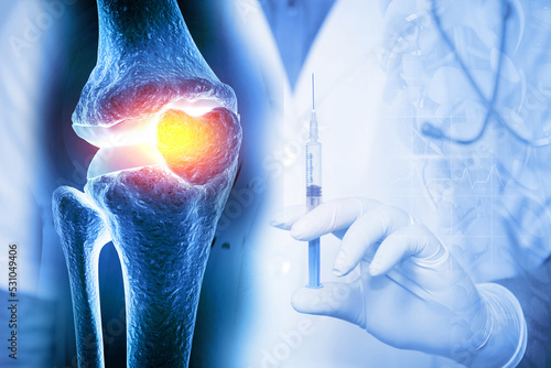 Anatomy Human Knee Joint Treatment, Osteoarthritis Injection, Drug Method Injection, knee injury, 3d illustration photo