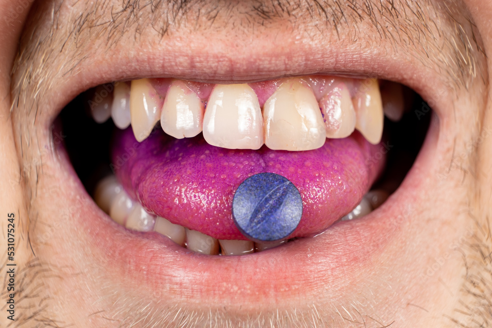 Obraz premium A person shows an indicator pill on his tongue to determine plaque.