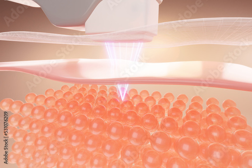 Fotografie HIFU face lifting laser shot on skin for skin tightening