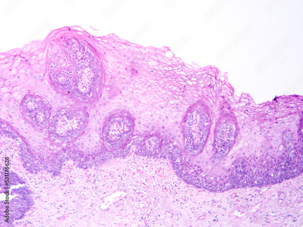 Histology of human tissue, show epithelial tissue and connective tissue with microscope view from laboratory (not Illustration Designation) Histology of human tissue, show epithelial tissue and connective tissue with microscope view from laboratory (not Illustration Designation)