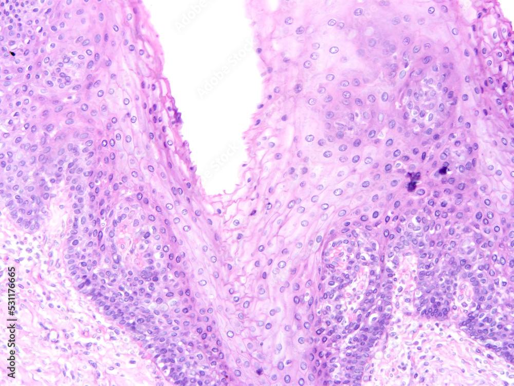 Histology of human tissue, show epithelial tissue and connective tissue with microscope view from laboratory (not Illustration Designation) Histology of human tissue, show epithelial tissue and connective tissue with microscope view from laboratory (not Illustration Designation)
