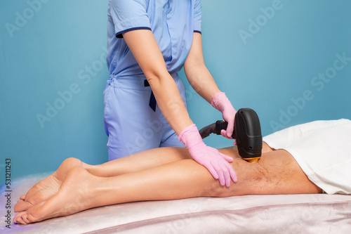 Professional cosmetologist does laser hair removal on woman's legs with varicose veins. Legs close-up. The concept of laser hair removal and varicosity