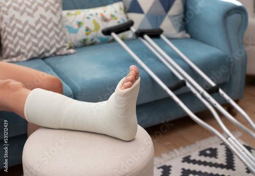 broken ankle and a leg cast. Leg splint