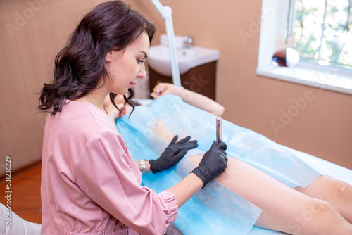 Treatment of skin problems with dermapen. Removal of stretch marks and scars on the body. A dermatologist performs the procedure with a dermapen device. Treatment of varicose veins and skin laxity.