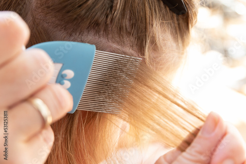 head lice head treatment,stock photography
