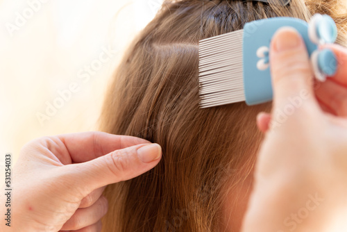 head lice head treatment,stock photography photo