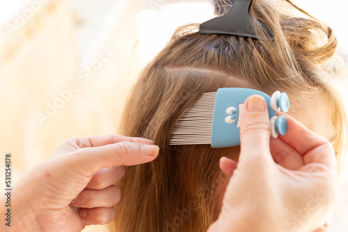 head lice head treatment,stock photography