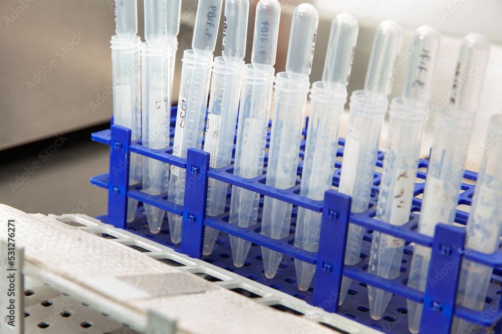 Patient samples ready to prepare slides for karyotype and fluorescence