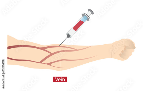 illustration of biology and medical, injecting vaccines into muscle, intravenous injection, injection of a medication or another substance into a vein and directly into the bloodstream