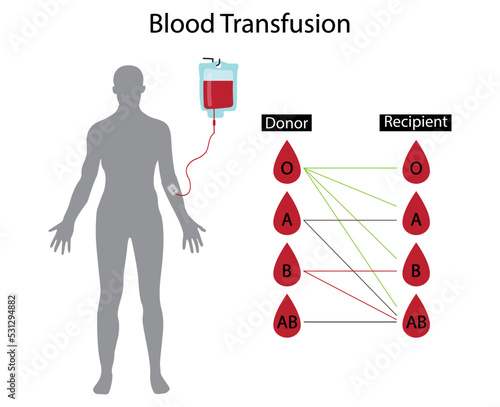 illustration of biology and medical, Blood transfusion is the process of transferring blood products into a person's circulation intravenously,  four major blood groups, Donate blood