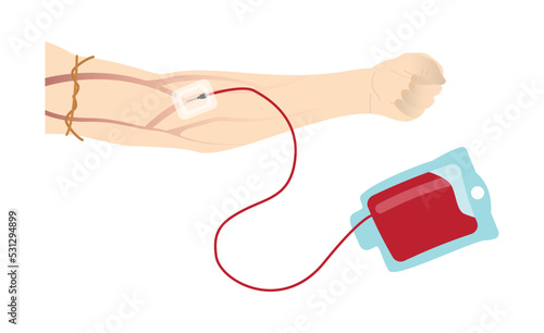 illustration of biology and Medical, Donate Blood, Platelets or Plasma, blood donations are truly life saving, A new sterile needle is inserted into a vein in arm