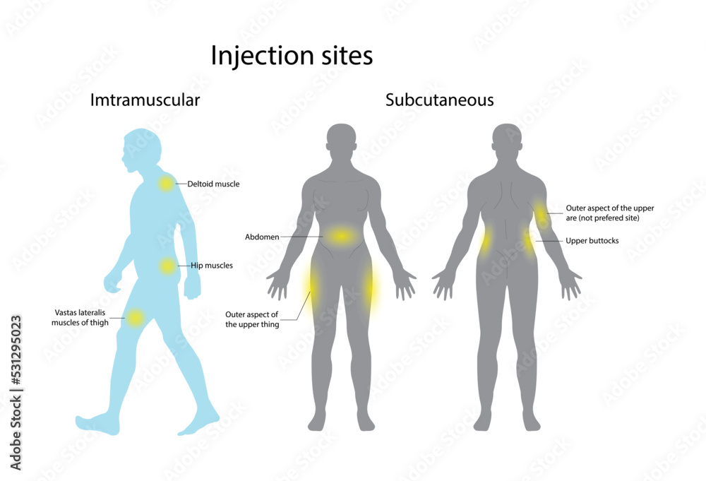 illustration of biology and medical, Several different sites can support an insulin injection