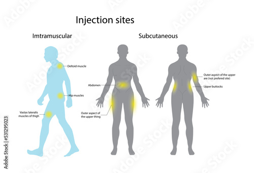 illustration of biology and medical, Several different sites can support an insulin injection, Insulin injection techniques, four sites on your body that can be used to give an intramuscular injection