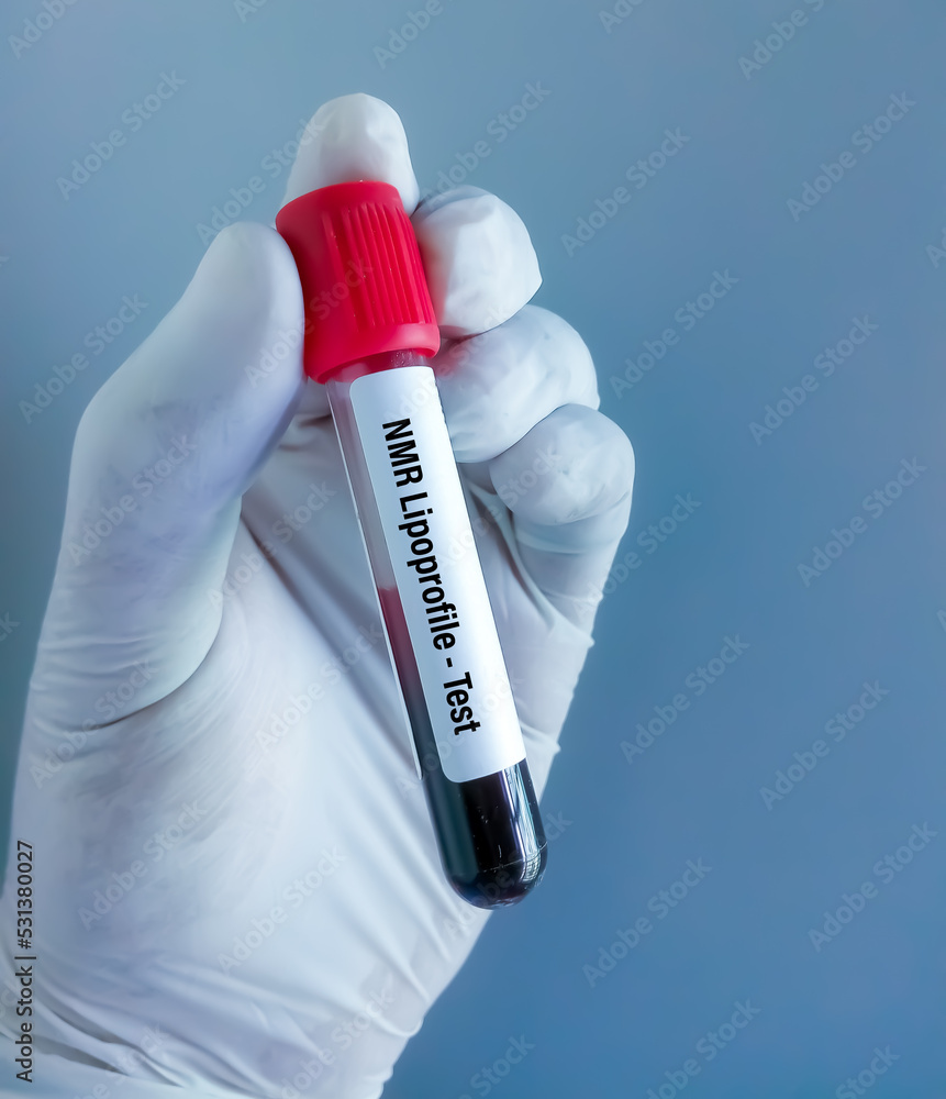 Naklejka premium Blood sample for NMR Lipoprofile test.