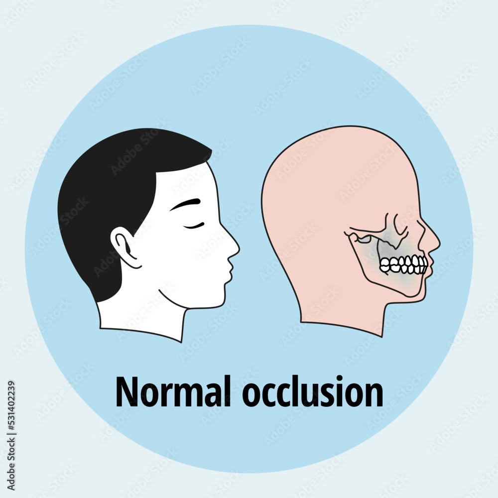 Side view of man after orthodontic treatment, right teeth aligned Side view of man after orthodontic treatment, right teeth aligned