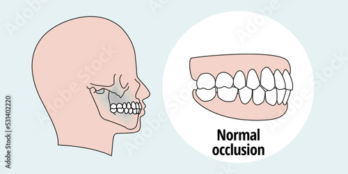 Side view of man after orthodontic treatment, right teeth aligned