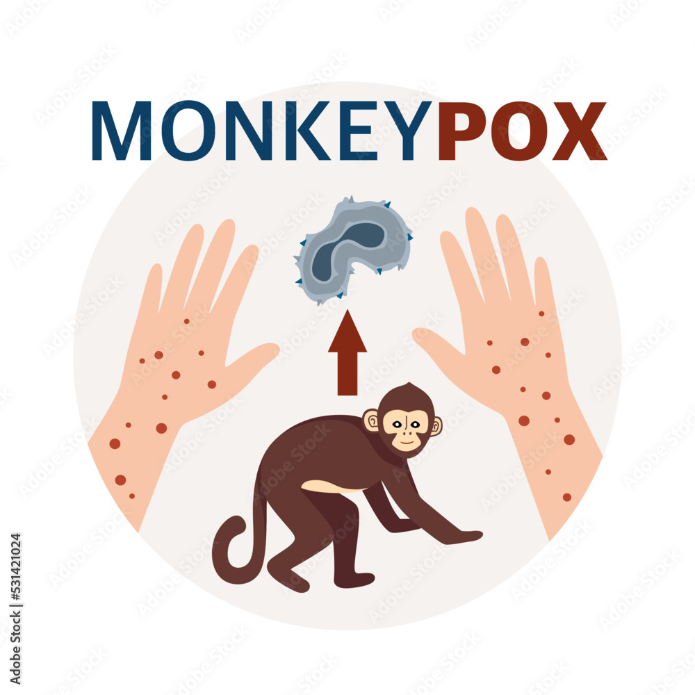 Monkey Pox virus Poster to inform about the pandemic and spread of the disease Images of human virus and monkey Vector Illustration