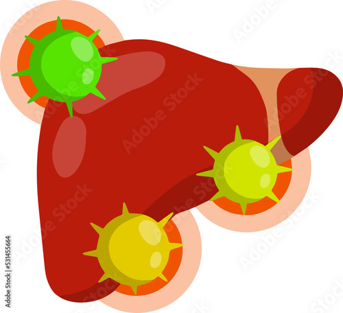 Bad liver. Attack germs and cirrhosis of the liver. Health problem