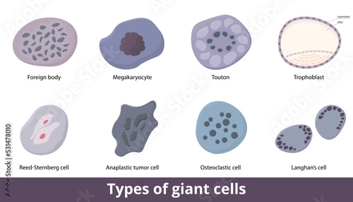 Types of giant cells. Eight types of giant cells include Langhan's, foreign body, Reed-Sternberg cell, different tumor cells, and trophoblast. Normal and inflammatory giant cell.