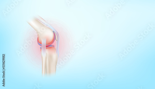 Arthritis knee joint and cartilage osteoarthritis side on blue background with copy space for text. Bone human skeleton anatomy of the body. Medical health care science concept. Realistic 3D Vector.