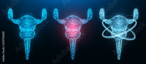 Polygonal vector illustration of inflamed diseased female uterus, healthy uterus and recovery of uterine functions. Female internal organ low poly design. Medical banner, template or background.