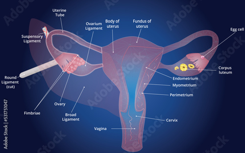 Uterus